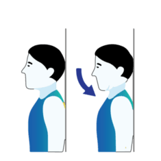 Chin Tuck exercise illustration