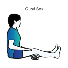 Quad Sets exercise illustration