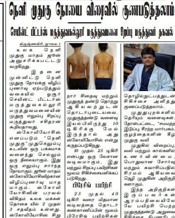 Press Feature — Scoliosis correction — before and after treatment.