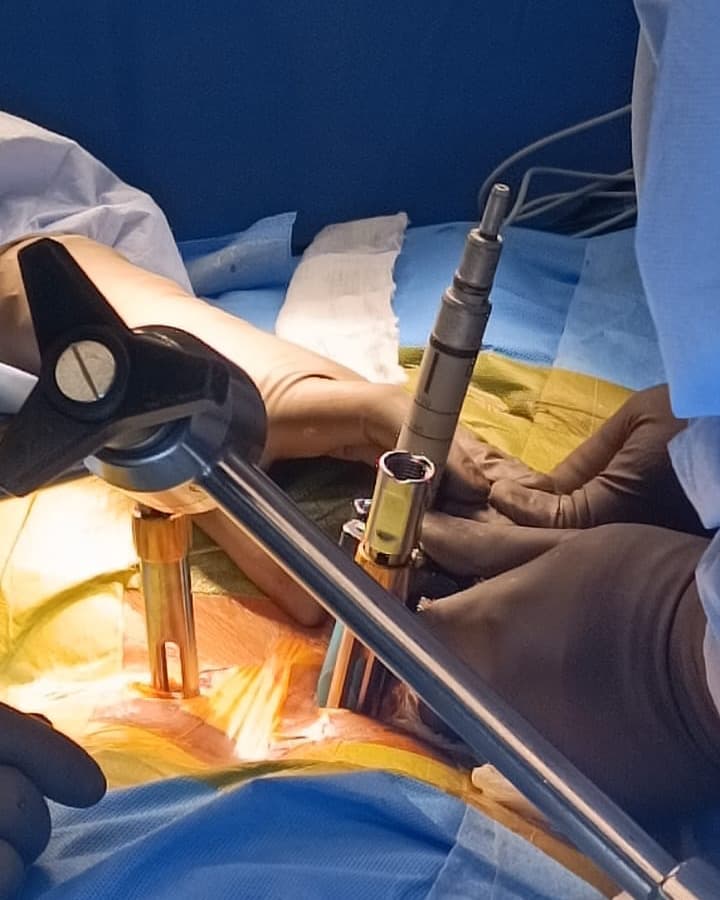 Dr. Sasidharan in the operating theatre